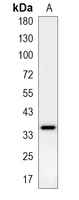 1 - Recombinant Anti-Kallikrein 5 Rabbit mAb AP95353