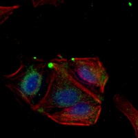 3 - Recombinant Anti-Arginase 2 Rabbit mAb AP95354