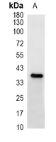 1 - Recombinant Anti-Arginase 2 Rabbit mAb AP95354