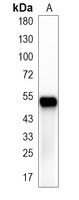 1 - Recombinant Anti-Glycerol Kinase 1 Rabbit mAb AP95356