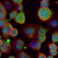3 - Recombinant Anti-CC2D1A Rabbit mAb AP95357