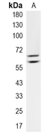 1 - Recombinant Anti-GATAD2A Rabbit mAb AP95358