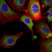 3 - Recombinant Anti-DSC3 Rabbit mAb AP95362