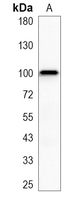 1 - Recombinant Anti-DSC3 Rabbit mAb AP95362