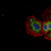 3 - Recombinant Anti-CCL27 Rabbit mAb AP95364