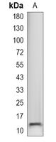 1 - Recombinant Anti-CCL27 Rabbit mAb AP95364