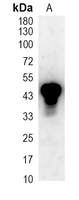 1 - Recombinant Anti-PTPN1/2 Rabbit mAb AP95367