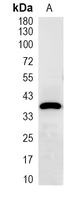 1 - Recombinant Anti-p40 phox Rabbit mAb AP95368