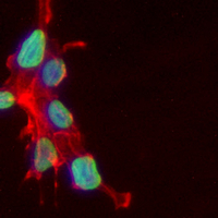 3 - Recombinant Anti-CPSF3 Rabbit mAb AP95369