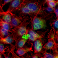 3 - Recombinant Anti-FGFR3 (Phospho-Y642) Rabbit mAb AP95370