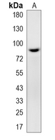 1 - Recombinant Anti-FGFR3 (Phospho-Y642) Rabbit mAb AP95370
