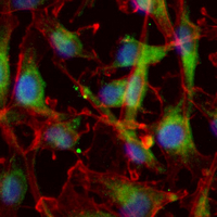 3 - Recombinant Anti-AGL Rabbit mAb AP95372
