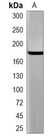 1 - Recombinant Anti-AGL Rabbit mAb AP95372