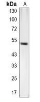 1 - Recombinant Anti-NPY5R Rabbit mAb AP95373