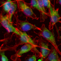 3 - Recombinant Anti-IL-12B Rabbit mAb AP95374