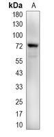 1 - Recombinant Anti-IL-12B Rabbit mAb AP95374