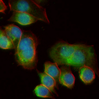 3 - Recombinant Anti-TAF15 Rabbit mAb AP95376