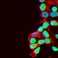 3 - Recombinant Anti-Nucleophosmin (Phospho-T199) Rabbit mAb AP95381