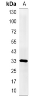 1 - Recombinant Anti-Nucleophosmin (Phospho-T199) Rabbit mAb AP95381