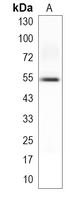 1 - Recombinant Anti-HNF4 alpha Rabbit mAb AP95382