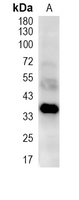 1 - Recombinant Anti-FDPS Rabbit mAb AP95384