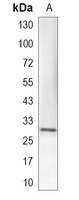 1 - Recombinant Anti-NAT1 Rabbit mAb AP95385