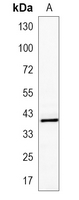1 - Recombinant Anti-MVK Rabbit mAb AP95386
