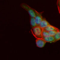 3 - Recombinant Anti-RBM3 Rabbit mAb AP95387