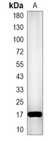 1 - Recombinant Anti-RBM3 Rabbit mAb AP95387