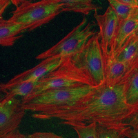 3 - Recombinant Anti-CYFIP1 Rabbit mAb AP95388