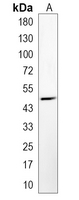 1 - Recombinant Anti-PAH Rabbit mAb AP95389