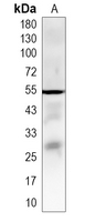 1 - Recombinant Anti-PTDSS2 Rabbit mAb AP95393