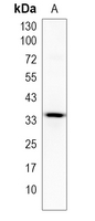 1 - Recombinant Anti-TMEM248 Rabbit mAb AP95394