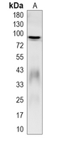 1 - Recombinant Anti-ZNF160 Rabbit mAb AP95396