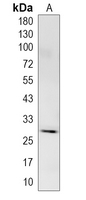 1 - Recombinant Anti-KCTD21 Rabbit mAb AP95397