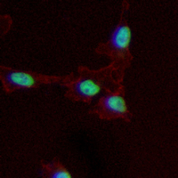 3 - Recombinant Anti-PHYHD1 Rabbit mAb AP95399