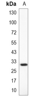 1 - Recombinant Anti-PHYHD1 Rabbit mAb AP95399