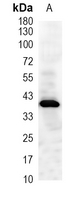1 - Recombinant Anti-ACTL8 Rabbit mAb AP95400