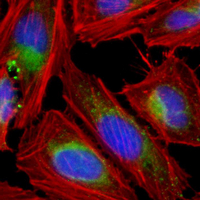 3 - Recombinant Anti-Syndapin-3 Rabbit mAb AP95402