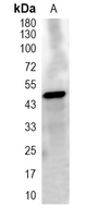 1 - Recombinant Anti-Syndapin-3 Rabbit mAb AP95402