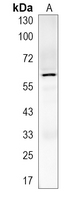 1 - Recombinant Anti-Jaw1 Rabbit mAb AP95403