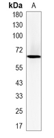 1 - Recombinant Anti-SLFN12 Rabbit mAb AP95404