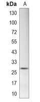 1 - Recombinant Anti-ALKBH2 Rabbit mAb AP95405