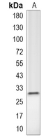 1 - Recombinant Anti-ZWINT Rabbit mAb AP95406