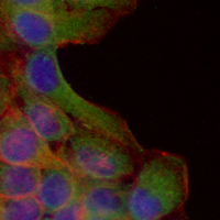 3 - Recombinant Anti-SRP72 Rabbit mAb AP95407