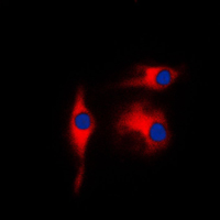 3 - Anti-Gamma-enolase Antibody AP95409
