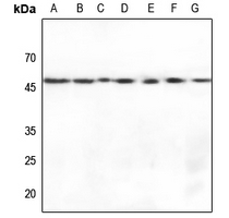 1 - Anti-Gamma-enolase Antibody AP95409