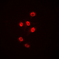 3 - Anti-Histone Deacetylase 1 Antibody [KO/KD Validated] AP95410