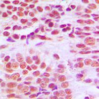 19 - Anti-Histone Deacetylase 1 Antibody [KO/KD Validated] AP95410