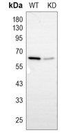 0 - Anti-Histone Deacetylase 1 Antibody [KO/KD Validated] AP95410